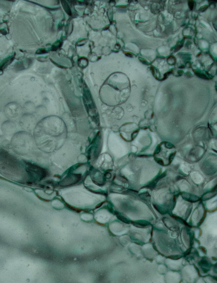 Stem Cell Filler